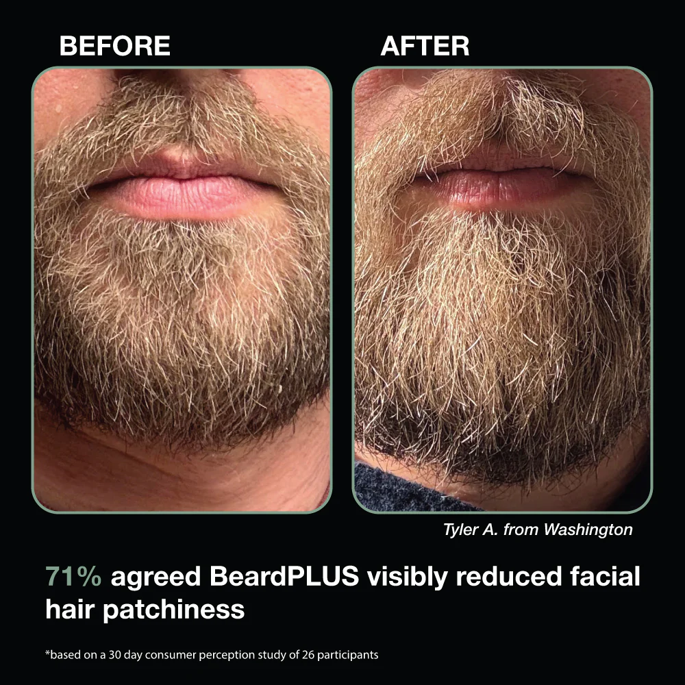 BeardPLUS Beard Care Kit - Image 5