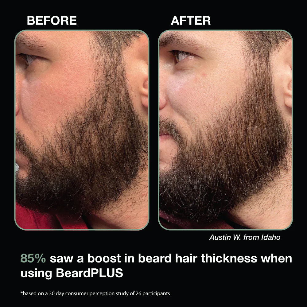 BeardPLUS Beard Care Kit - Image 6